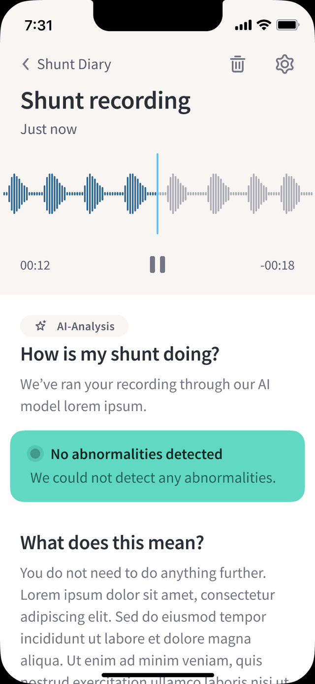 ShuntWizard app — Result detail showing healthy/no abnormalities status