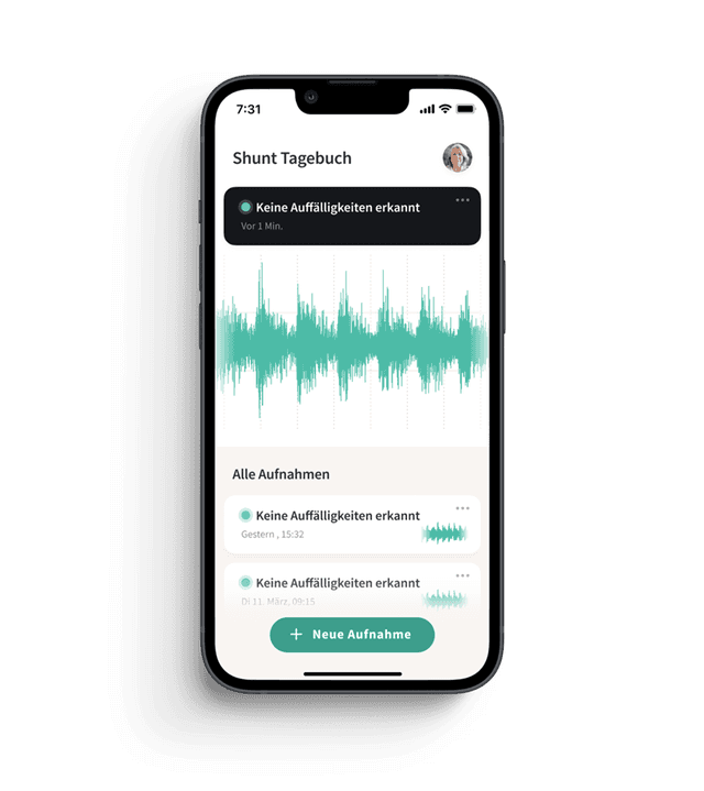 ShuntWizard patient app showing shunt diary home screen